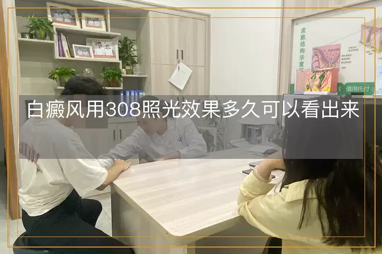 白癜风用308照光效果多久可以看出来