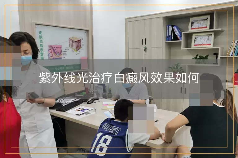 紫外线光治疗白癜风效果如何