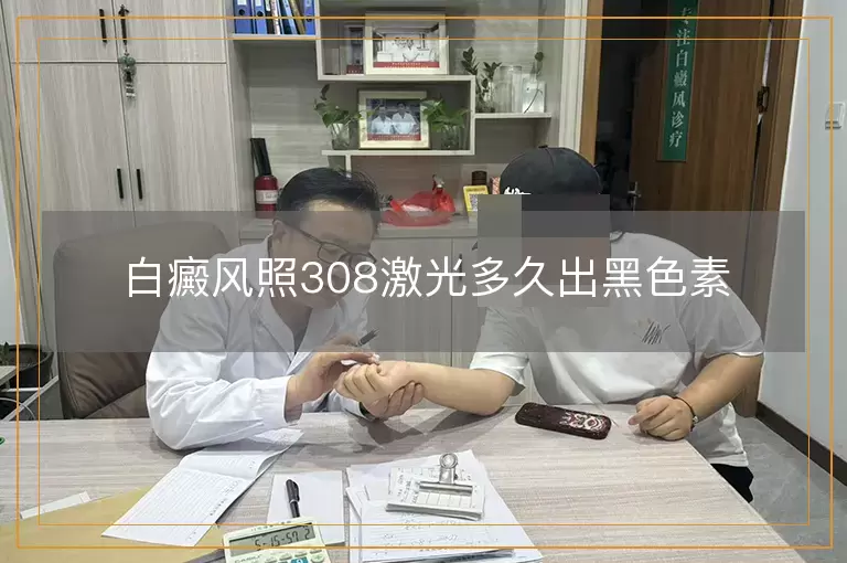 白癜风照308激光多久出黑色素