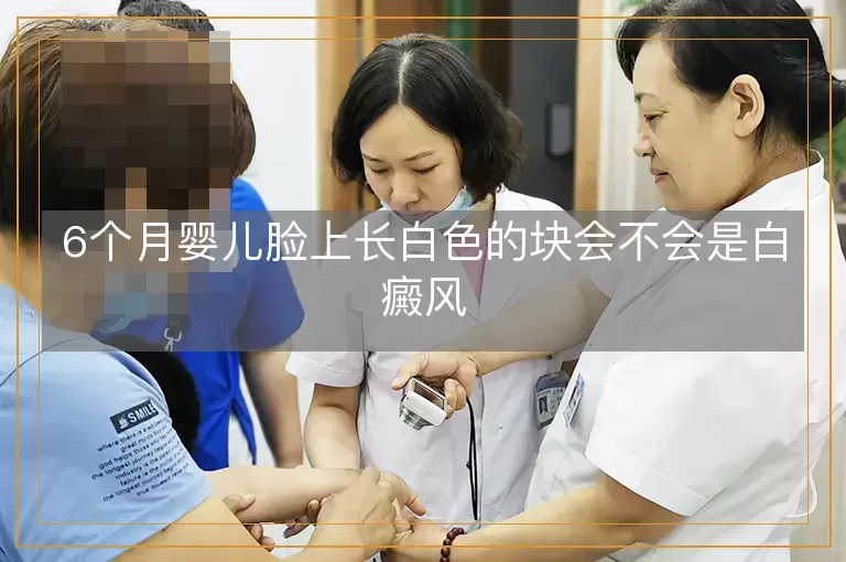 6个月婴儿脸上长白色的块会不会是白癜风