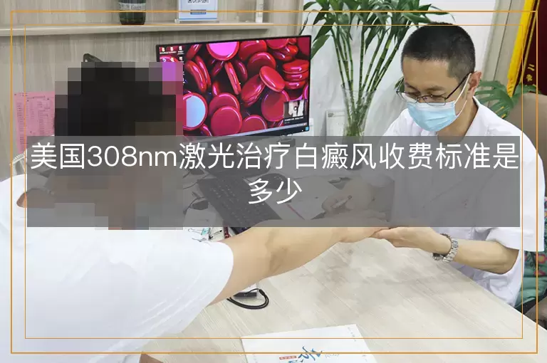 美国308nm激光治疗白癜风收费标准是多少