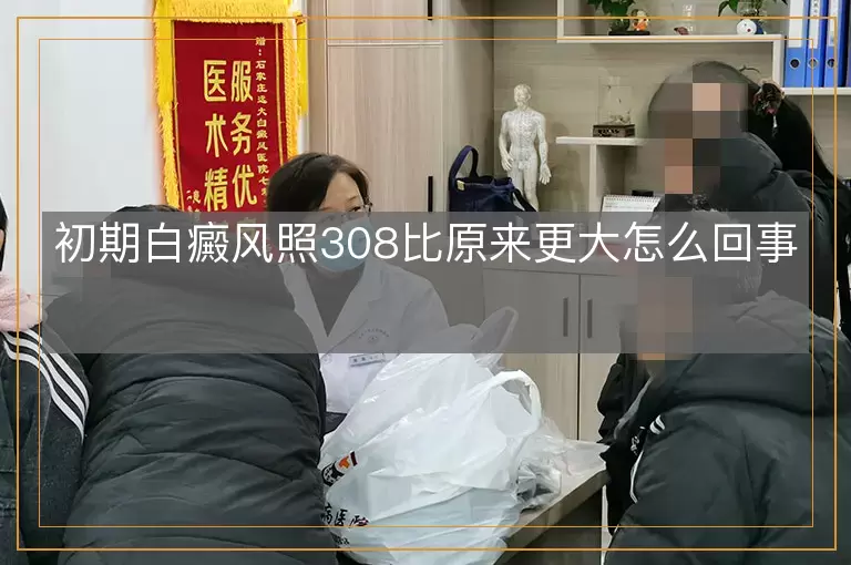 初期白癜风照308比原来更大怎么回事