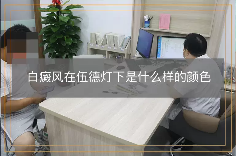 白癜风在伍德灯下是什么样的颜色