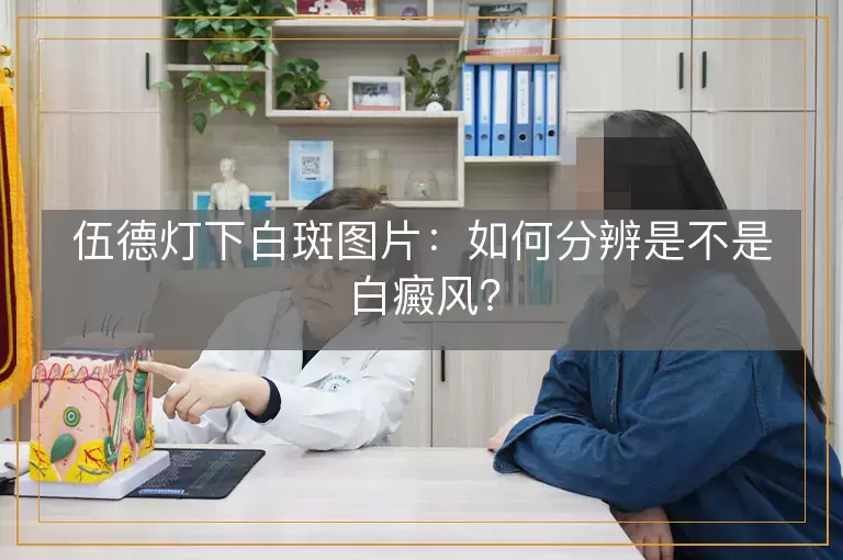 伍德灯下白斑图片：如何分辨是不是白癜风？