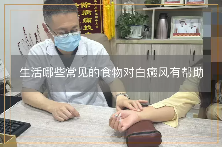 生活哪些常见的食物对白癜风有帮助