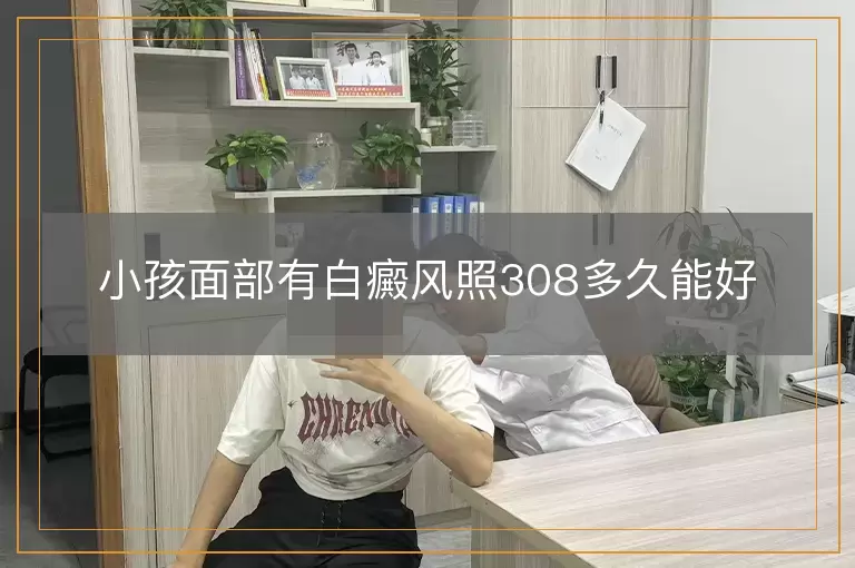 小孩面部有白癜风照308多久能好