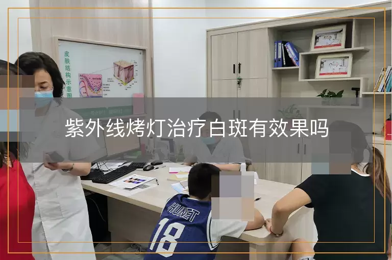 紫外线烤灯治疗白斑有效果吗