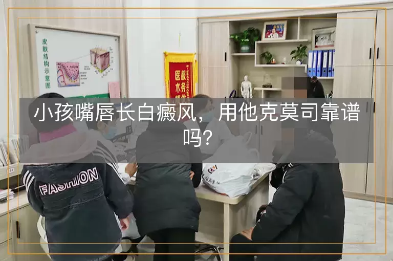 小孩嘴唇长白癜风，用他克莫司靠谱吗？