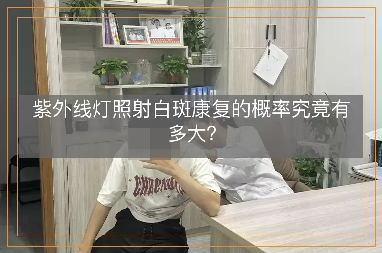 紫外线灯照射白斑康复的概率究竟有多大？