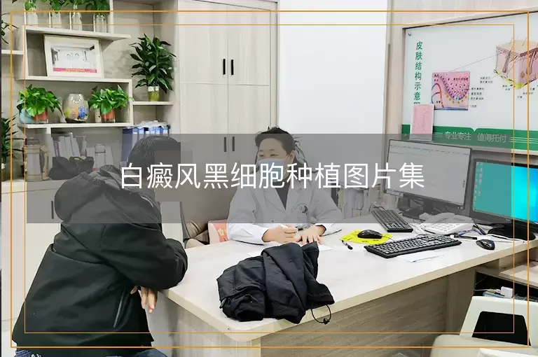 白癜风黑细胞种植图片集