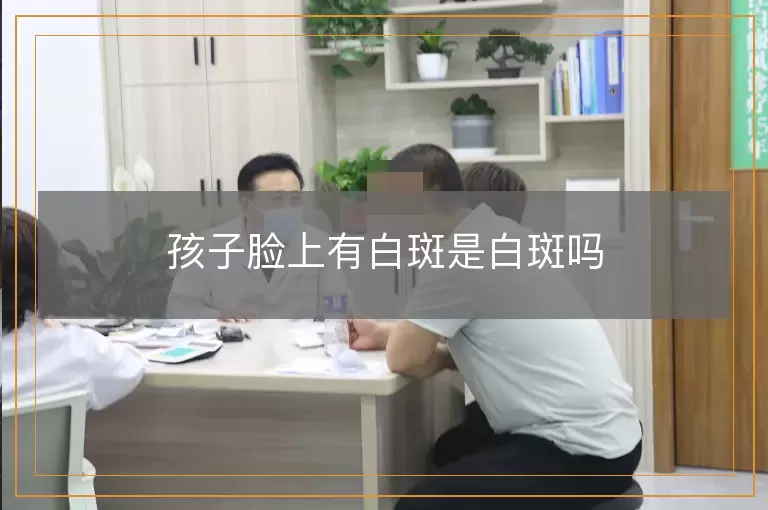 孩子脸上有白斑是白斑吗