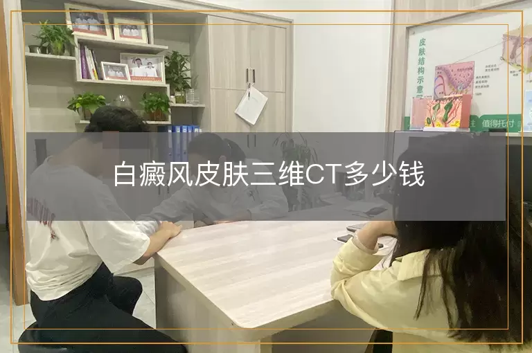 白癜风皮肤三维CT多少钱