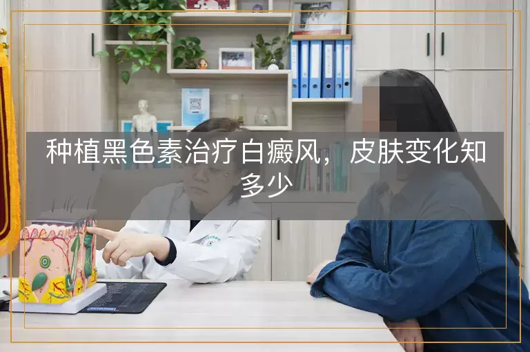 种植黑色素治疗白癜风，皮肤变化知多少