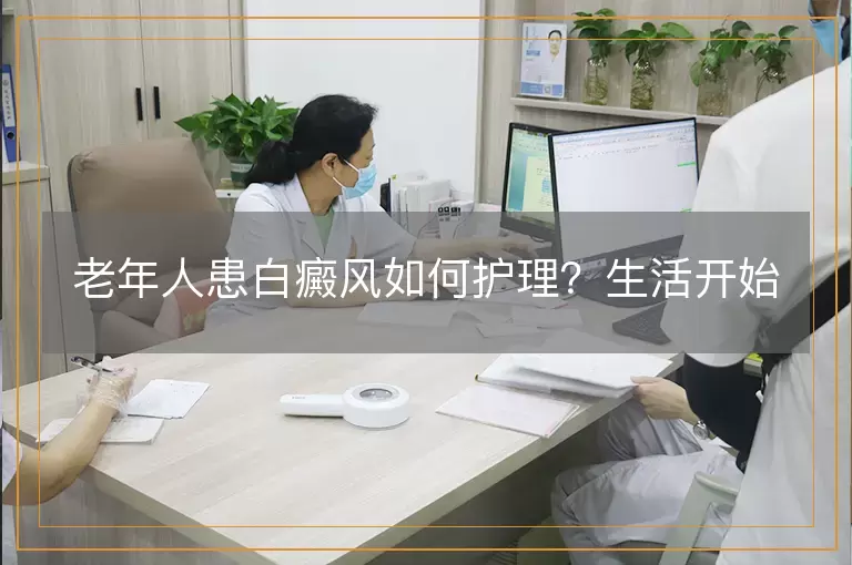 老年人患白癜风如何护理？生活开始