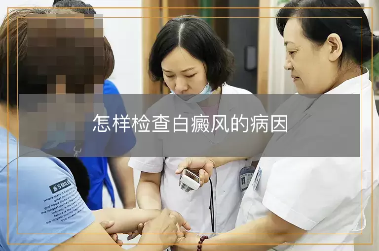 怎样检查白癜风的病因