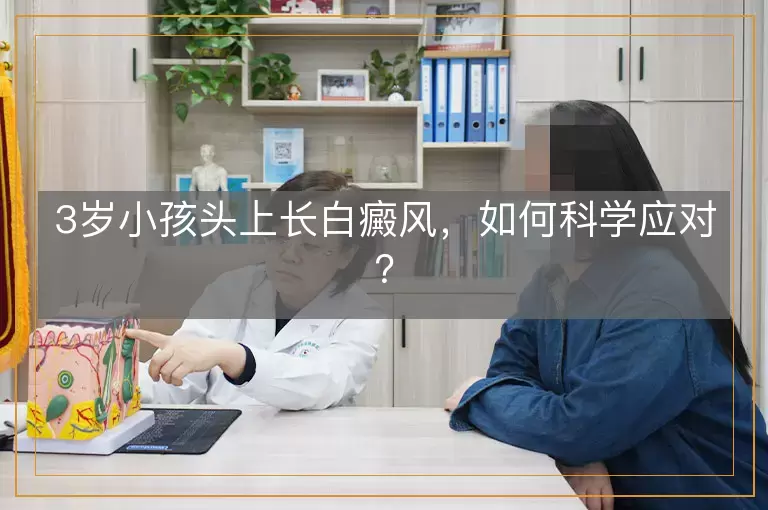 3岁小孩头上长白癜风，如何科学应对？