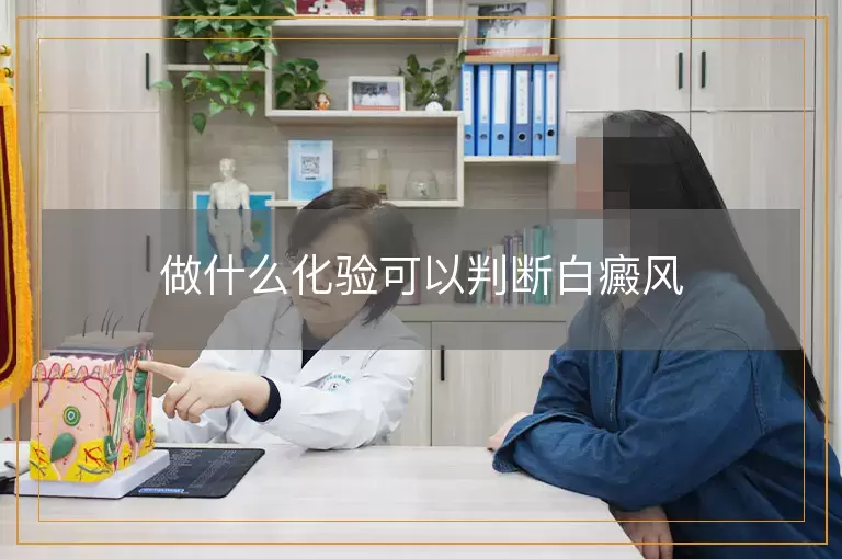 做什么化验可以判断白癜风