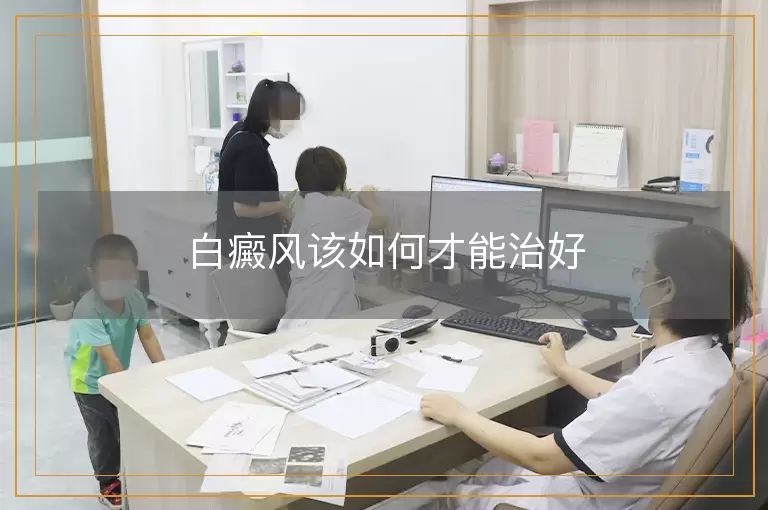 白癜风该如何才能治好