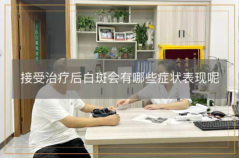 接受治疗后白斑会有哪些症状表现呢