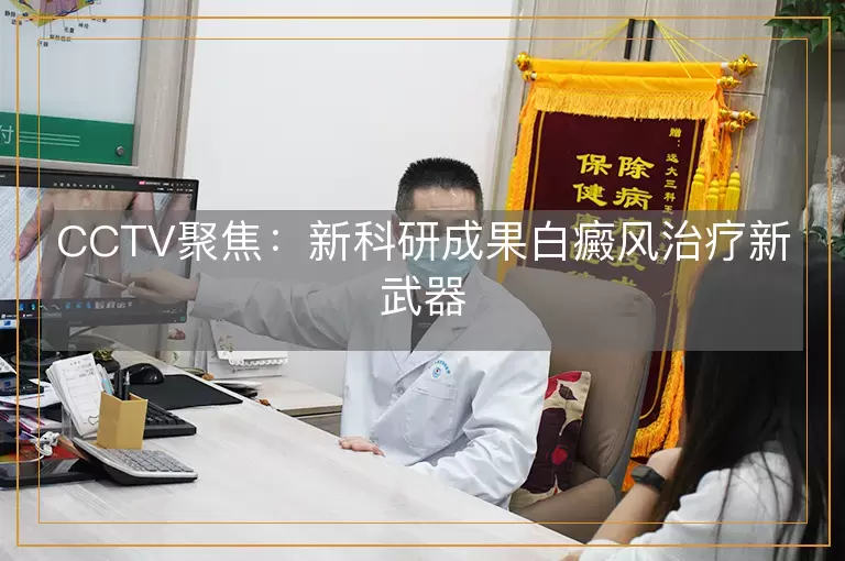 CCTV聚焦：新科研成果白癜风治疗新武器