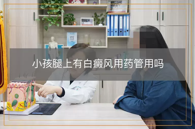 小孩腿上有白癜风用药管用吗