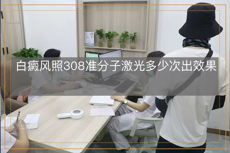 白癜风照308准分子激光多少次出效果