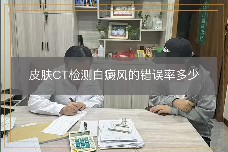 皮肤CT检测白癜风的错误率多少