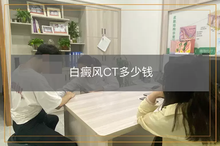白癜风CT多少钱