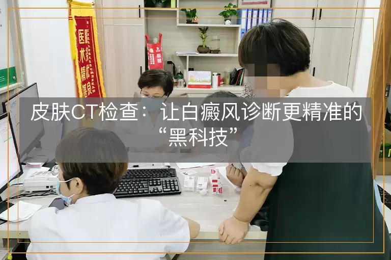 皮肤CT检查：让白癜风诊断更精准的“黑科技”