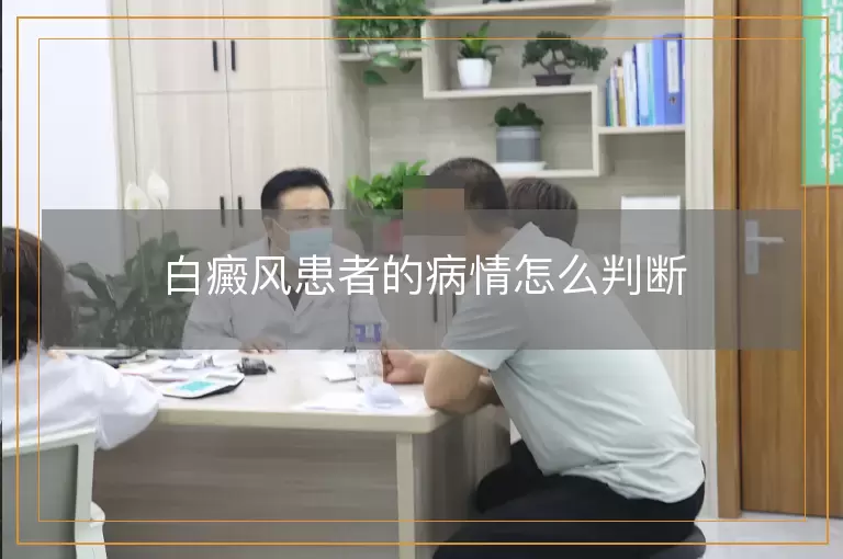 白癜风患者的病情怎么判断