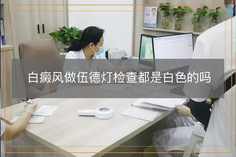 白癜风做伍德灯检查都是白色的吗