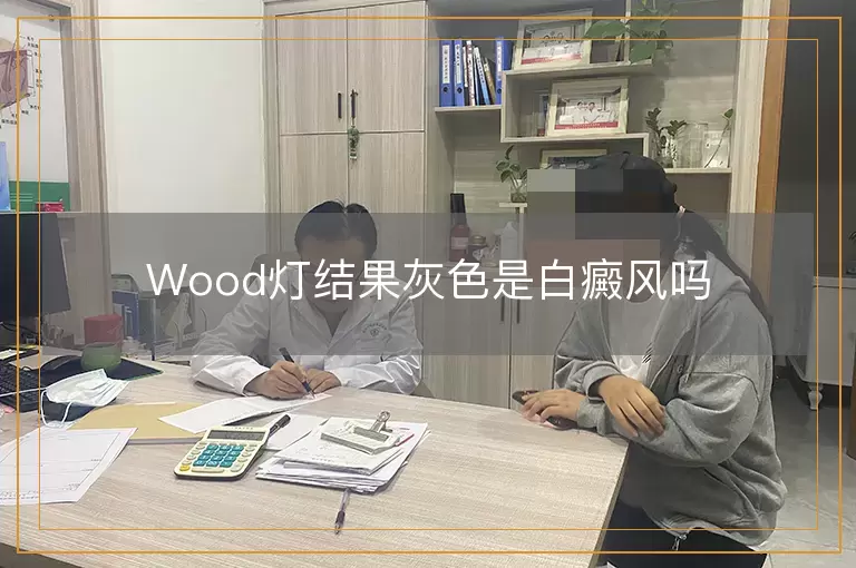 Wood灯结果灰色是白癜风吗