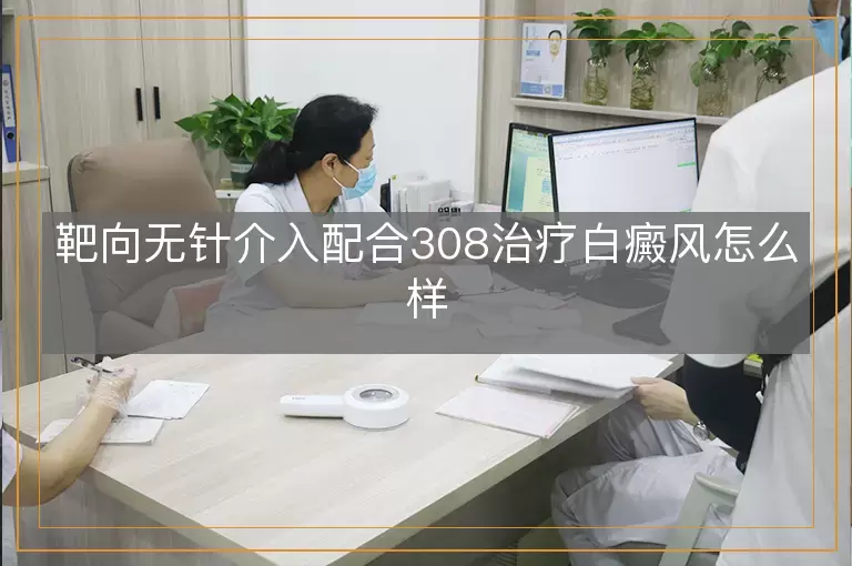 靶向无针介入配合308治疗白癜风怎么样