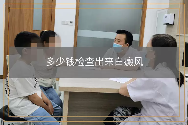 多少钱检查出来白癜风