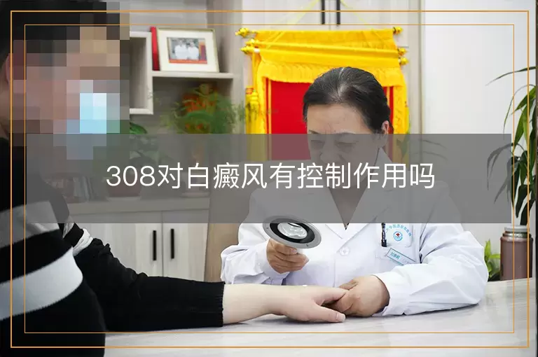 308对白癜风有控制作用吗
