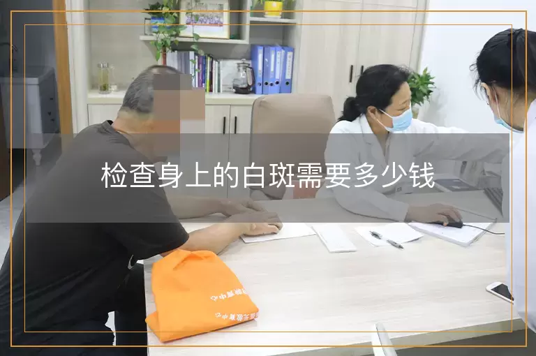 检查身上的白斑需要多少钱
