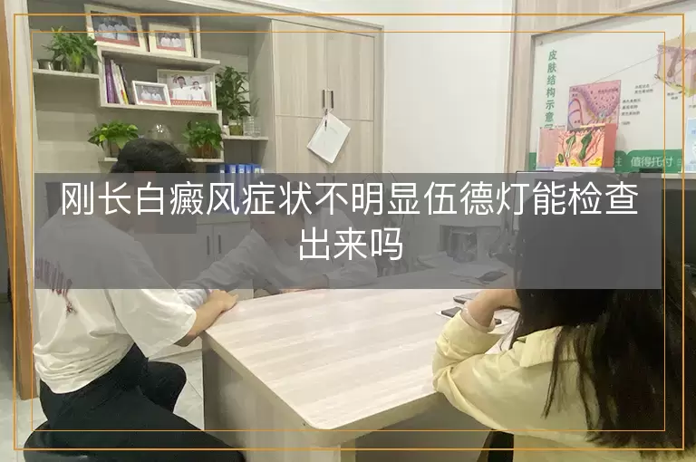 刚长白癜风症状不明显伍德灯能检查出来吗