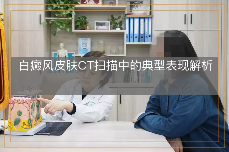 白癜风皮肤CT扫描中的典型表现解析