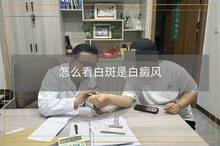 怎么看白斑是白癜风