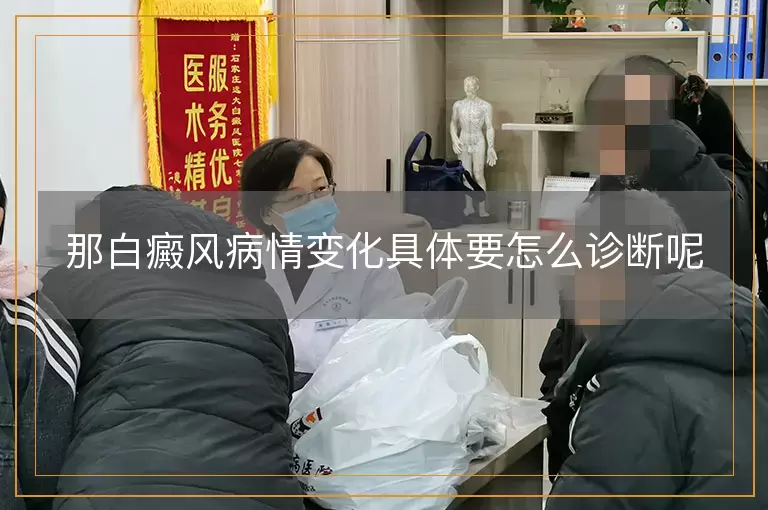 那白癜风病情变化具体要怎么诊断呢