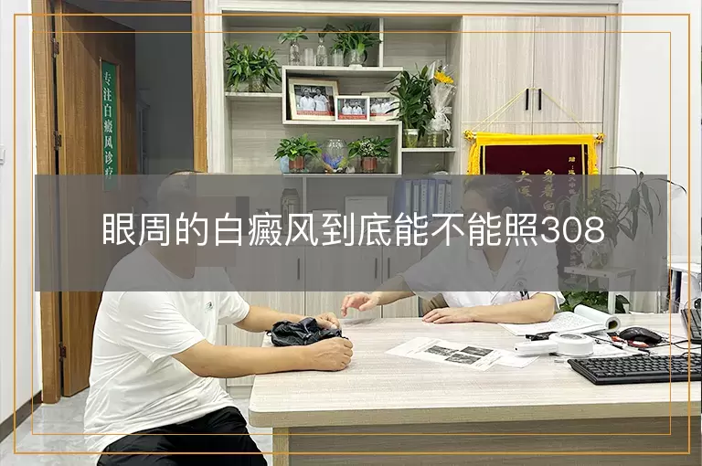 眼周的白癜风到底能不能照308