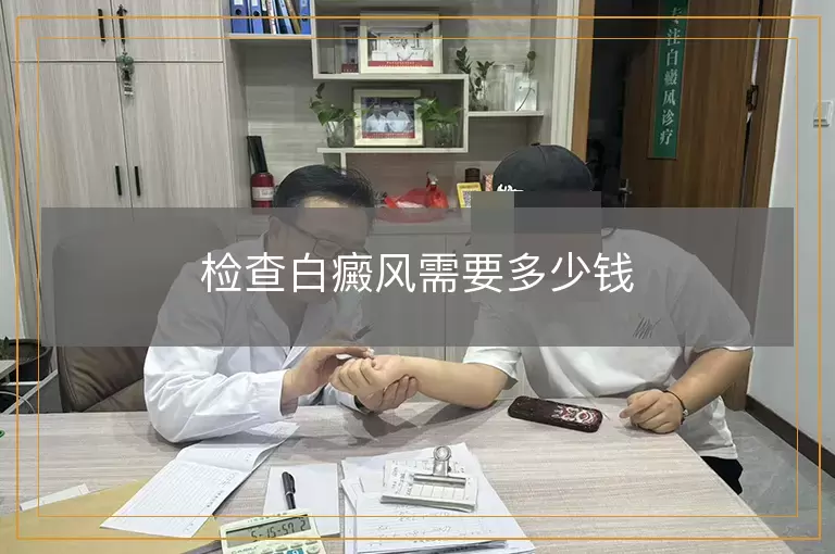 检查白癜风需要多少钱