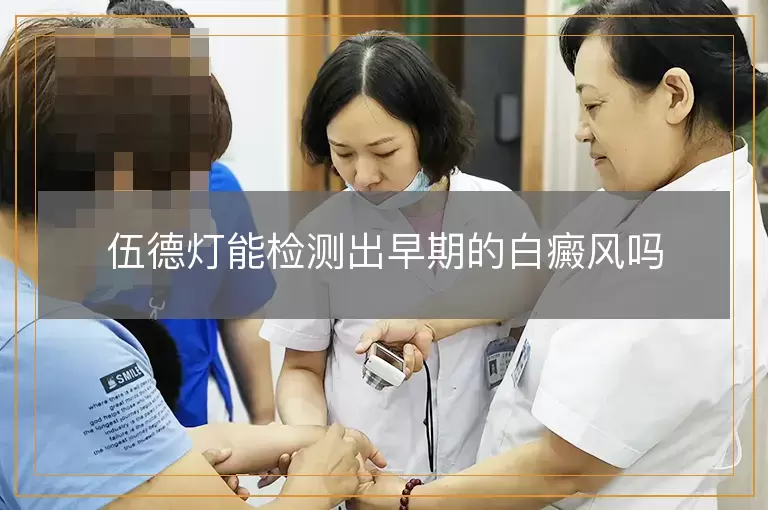 伍德灯能检测出早期的白癜风吗