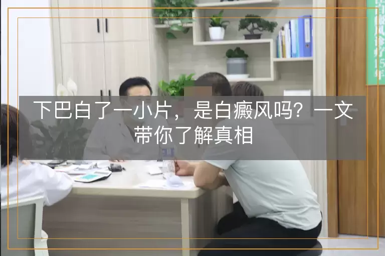 下巴白了一小片，是白癜风吗？一文带你了解真相
