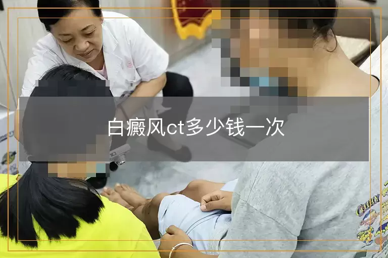 白癜风ct多少钱一次