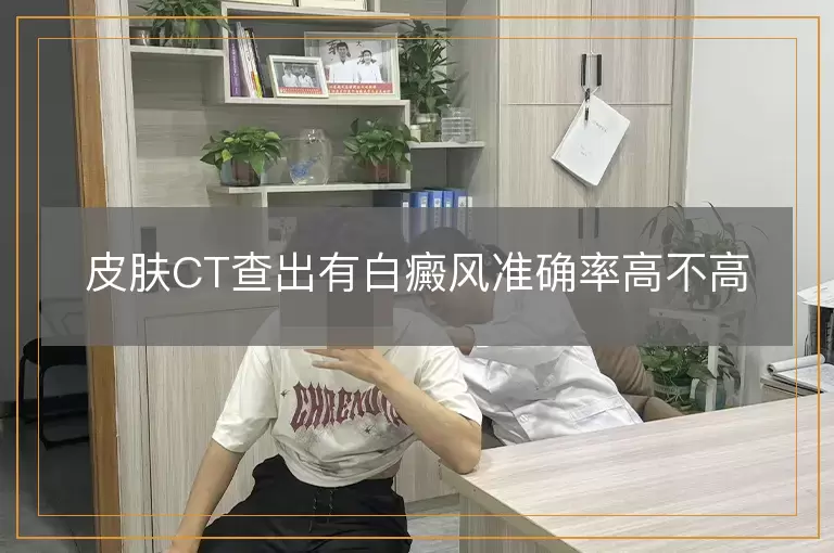 皮肤CT查出有白癜风准确率高不高
