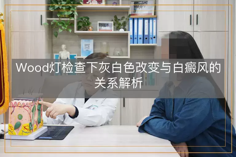 Wood灯检查下灰白色改变与白癜风的关系解析