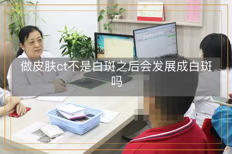 做皮肤ct不是白斑之后会发展成白斑吗