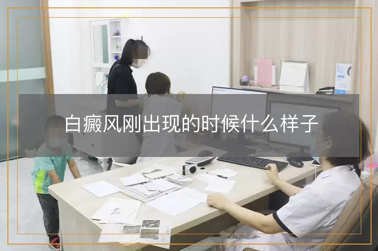白癜风刚出现的时候什么样子