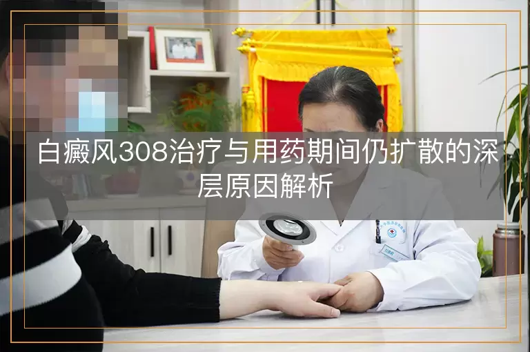 白癜风308治疗与用药期间仍扩散的深层原因解析